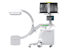 大平板一體式C形臂骨科臨床案例分享