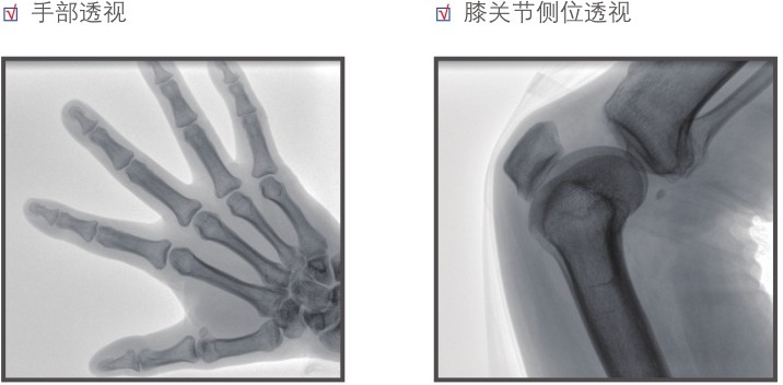 平板小C手指骨成像效果