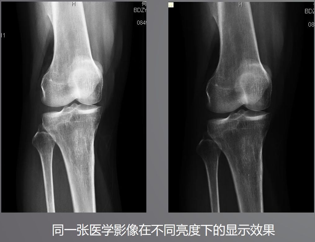 寵物DR設(shè)備的顯示器有要求？普通和醫(yī)用顯示器有什么區(qū)別